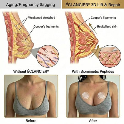 NEYEROS® Targeted Breast Enhancement Advanced Nano Microneedle Patch