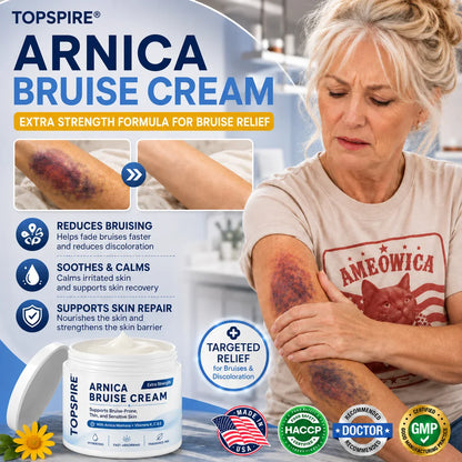 💕 TOPSPIRE® Arnica Bruise Cream