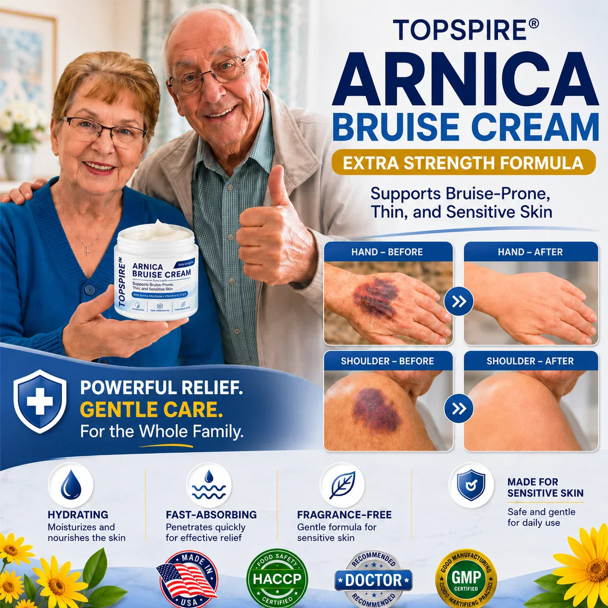 💕 TOPSPIRE® Arnica Bruise Cream