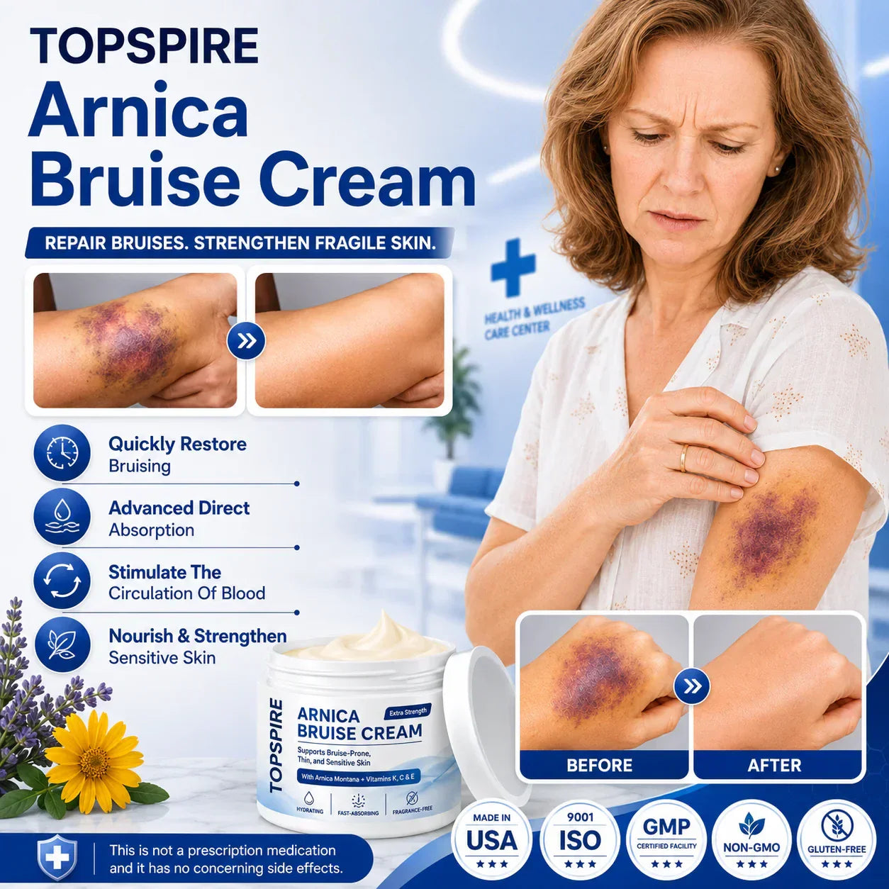💕 TOPSPIRE® Arnica Bruise Cream